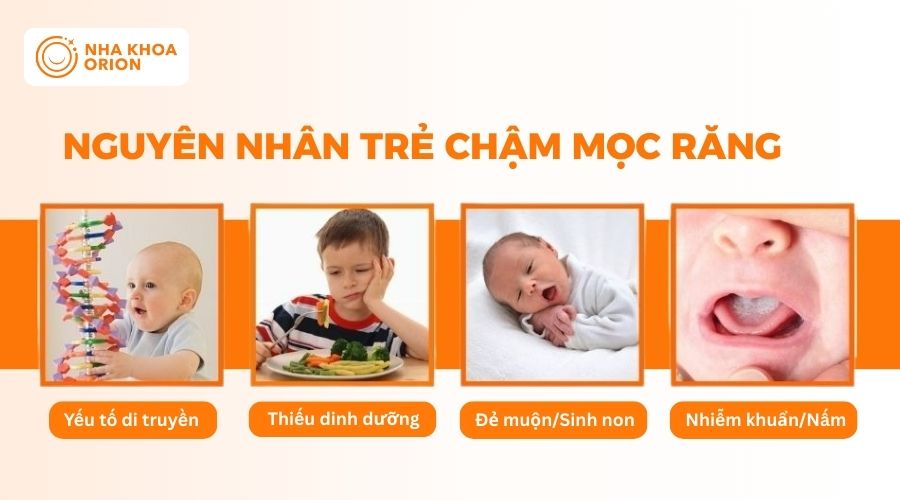Những nguy&ecirc;n nh&acirc;n khiến trẻ chậm mọc răng