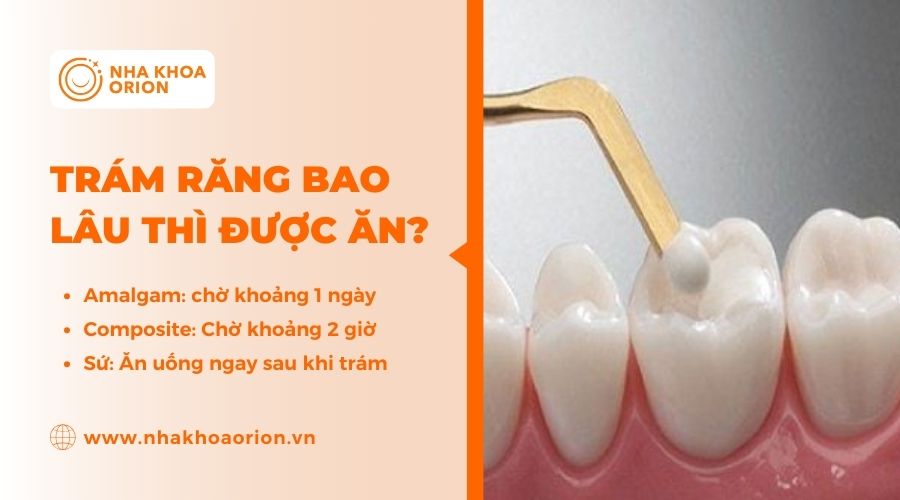 Giải đ&aacute;p tr&aacute;m răng bao l&acirc;u th&igrave; được ăn