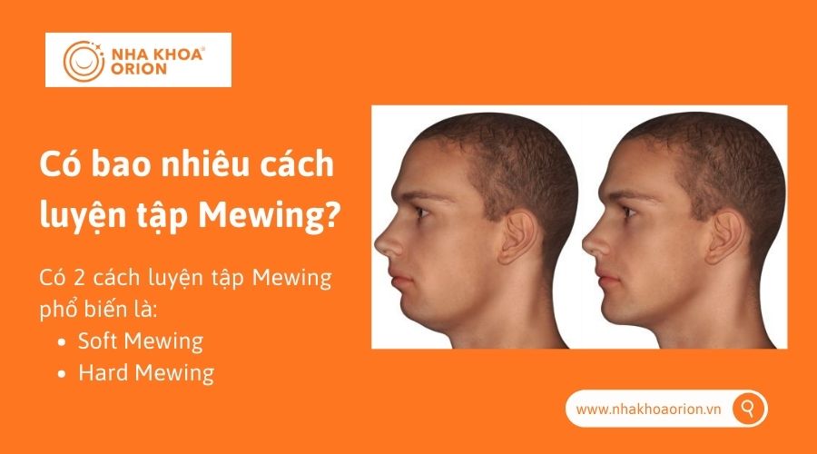 Có bao nhiêu cách luyện tập Mewing