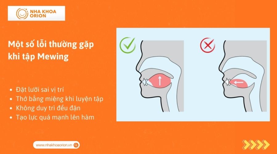 Một số lỗi thường gặp khi tập Mewing mũi cao