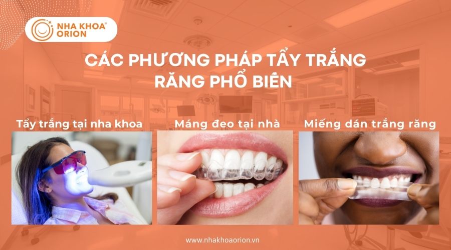 Các phương pháp tẩy trắng phổ biến hiện nay