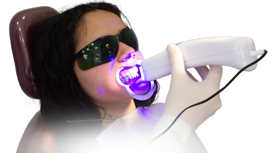 Vì sao nên chọn dịch vụ tẩy trắng răng tại Nha Khoa Orion?