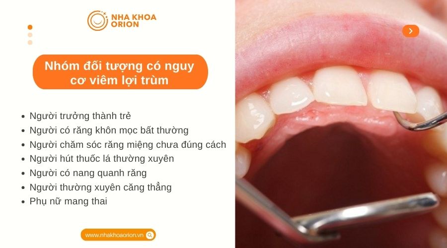 Nh&oacute;m đối tượng c&oacute; nguy cơ vi&ecirc;m lợi tr&ugrave;m