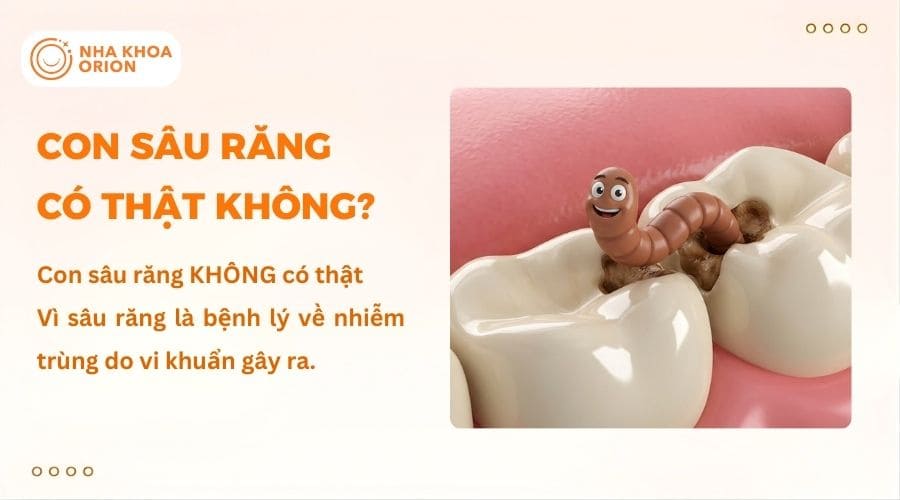Giải đ&aacute;p chi tiết con s&acirc;u răng c&oacute; thật kh&ocirc;ng