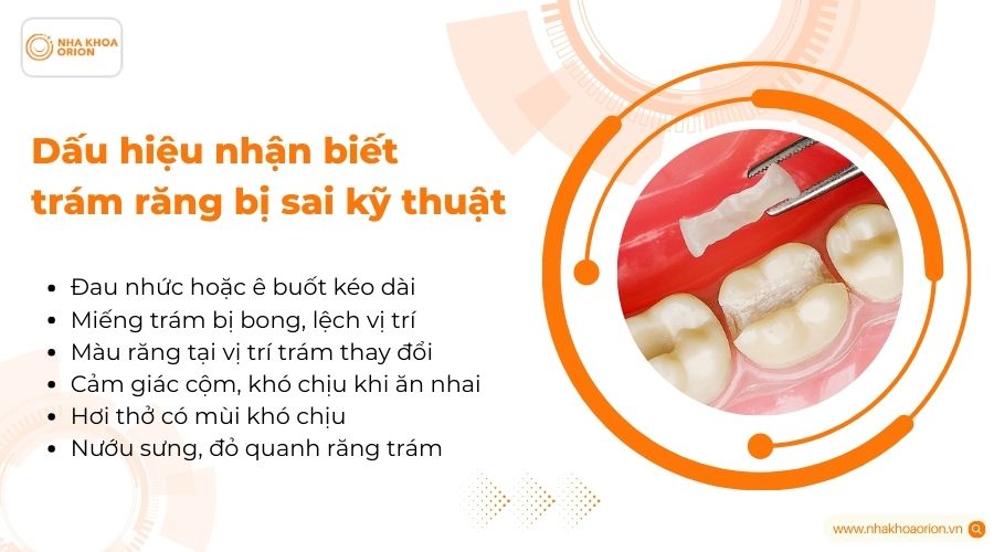 Dấu hiệu nhận biết tr&aacute;m răng bị sai kỹ thuật&nbsp;