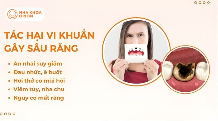 Những t&aacute;c hại, hệ lụy khi bị s&acirc;u răng