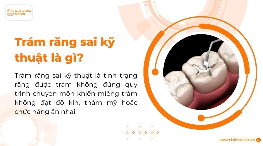 Tr&aacute;m răng sai kỹ thuật l&agrave; g&igrave;?