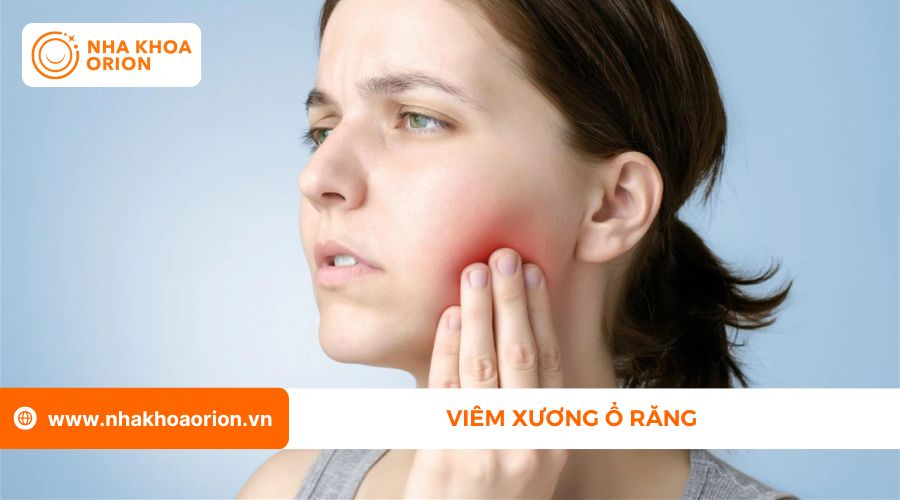 Vi&ecirc;m xương ổ răng l&agrave; biến chứng sau khi nhổ răng kh&ocirc;n