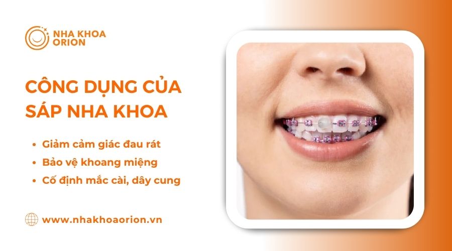 S&aacute;p nha khoa gi&uacute;p giảm đau do ma s&aacute;t của kh&iacute; cụ niềng răng v&agrave; khoang miệng