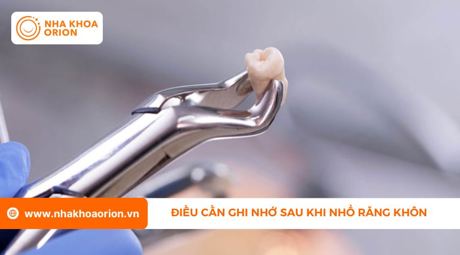 Dấu hiệu nguy hiểm sau khi nhổ răng kh&ocirc;n ai cũng n&ecirc;n biết