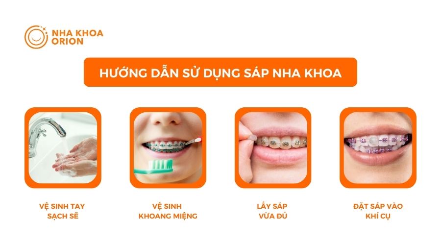 Hướng dẫn sử dụng s&aacute;p nha khoa đ&uacute;ng c&aacute;ch