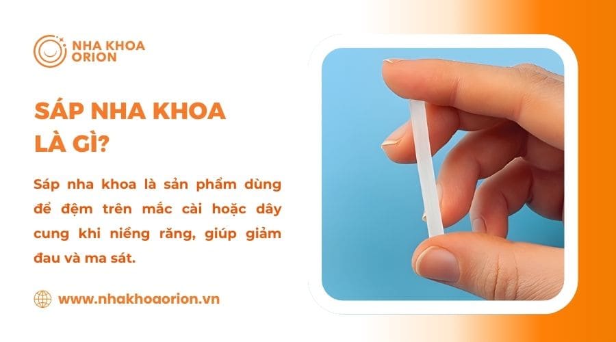 T&igrave;m hiểu s&aacute;p nha khoa trong niềng răng l&agrave; g&igrave;