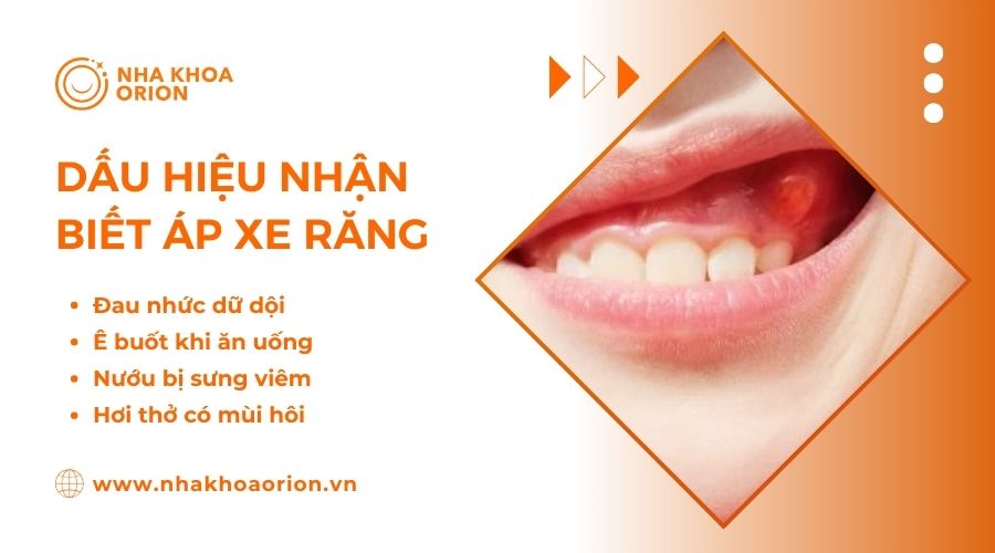 &Aacute;p xe răng c&oacute; thể g&acirc;y rụng răng v&agrave; nhiễm tr&ugrave;ng m&aacute;u