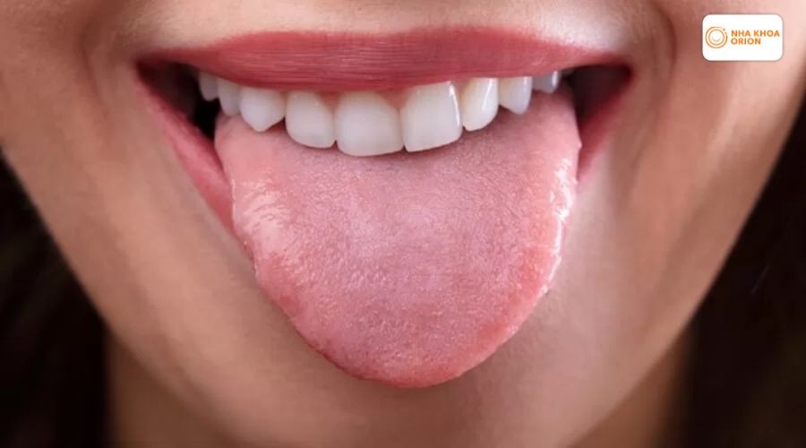 Nh&uacute; lưỡi xẹp, hồng h&agrave;o trở lại