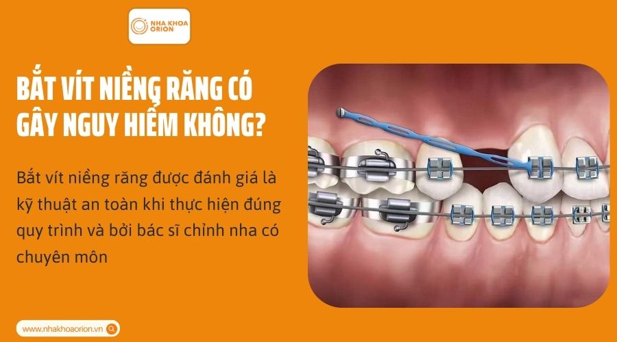 Bắt v&iacute;t niềng răng c&oacute; nguy hiểm kh&ocirc;ng?