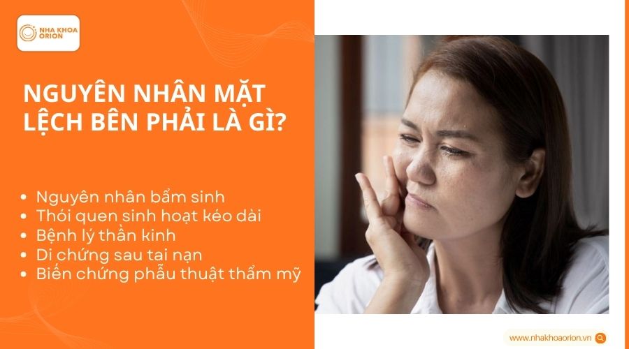 Nguyên nhân mặt lệch bên phải là gì?