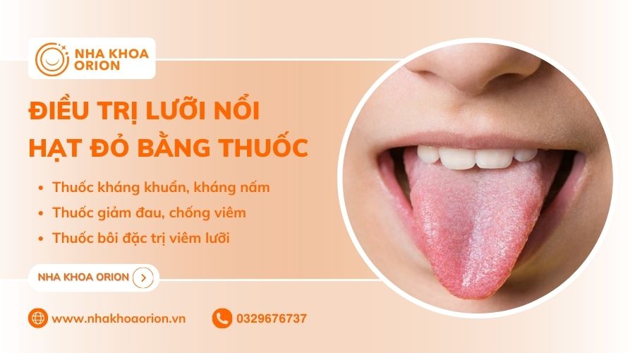 Cách điều trị lưỡi nổi hạt đỏ bằng thuốc chuyên dụng