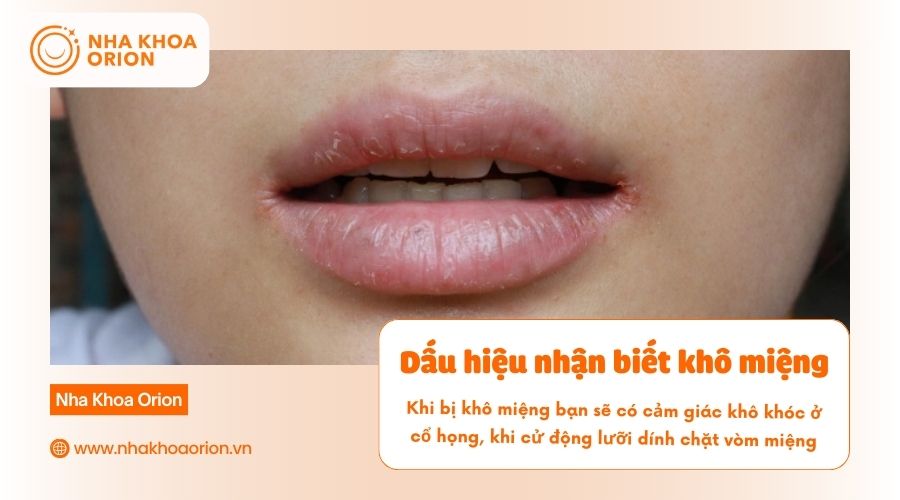 Kh&ocirc; miệng thường khiếng hơi thở c&oacute; m&ugrave;i h&ocirc;i