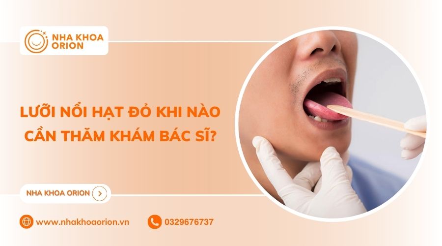 Lưỡi nổi hạt đỏ thường không phải tình trạng nguy hiểm