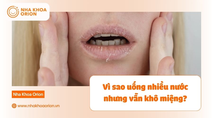 Uống nước nhiều m&agrave; vẫn kh&ocirc; miệng c&oacute; thể do mắc bệnh l&yacute;