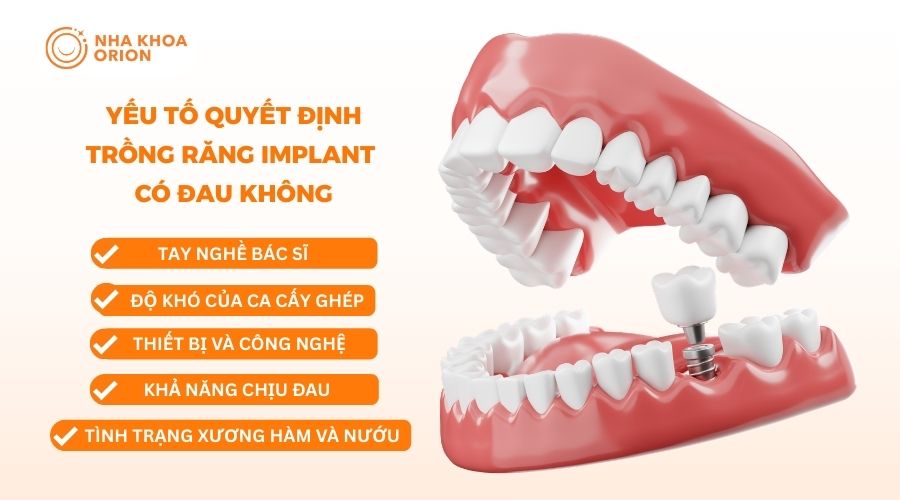 Yếu tố quyết định độ đau khi trồng răng Implant