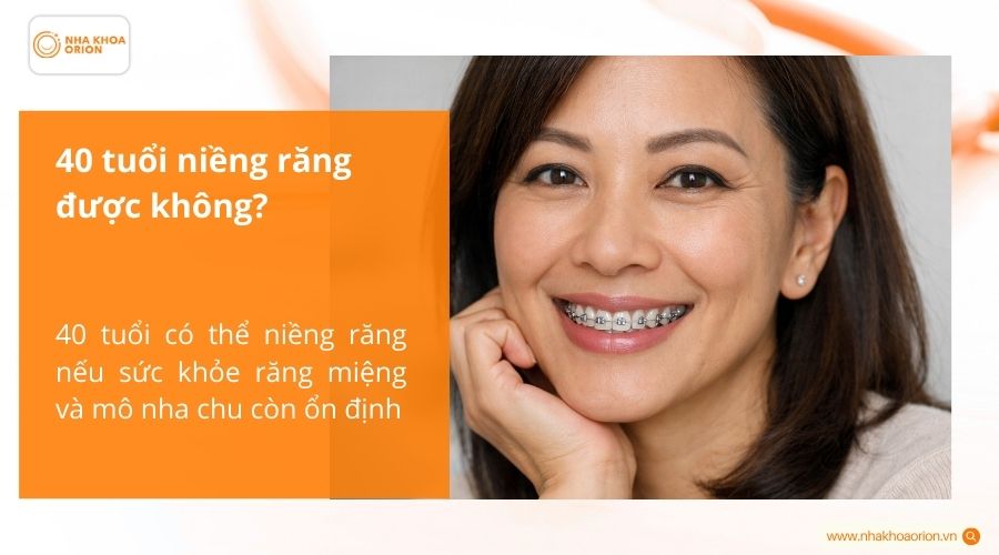 40 tuổi niềng răng được kh&ocirc;ng?