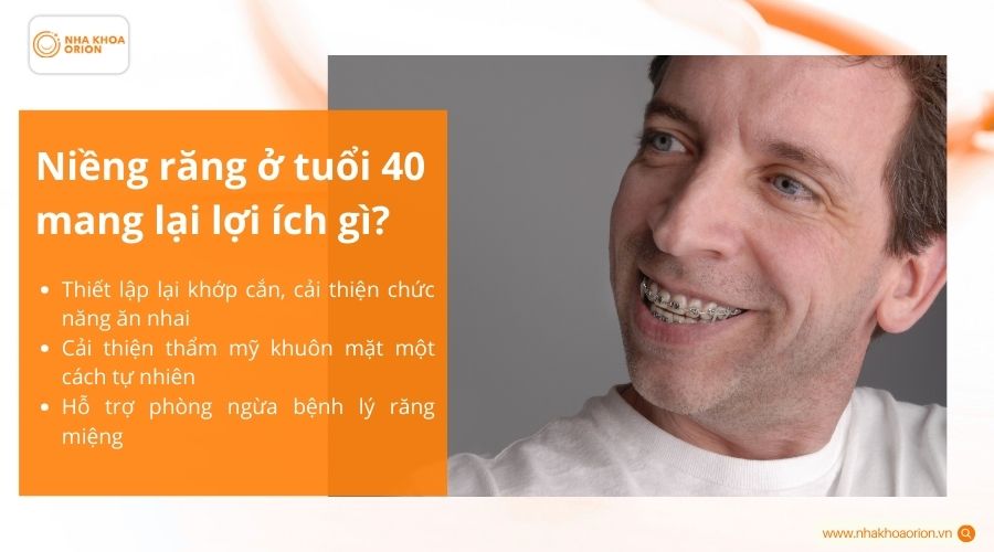 Niềng răng ở tuổi 40 mang lại lợi &iacute;ch g&igrave;?