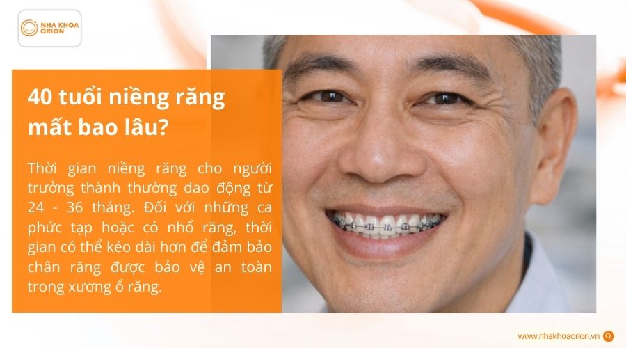 40 tuổi niềng răng mất bao l&acirc;u?