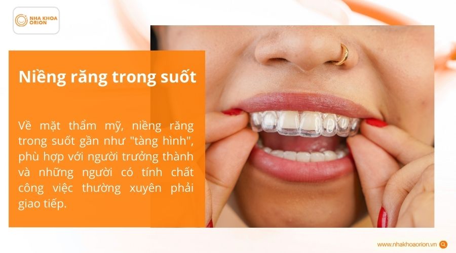 Niềng răng trong suốt