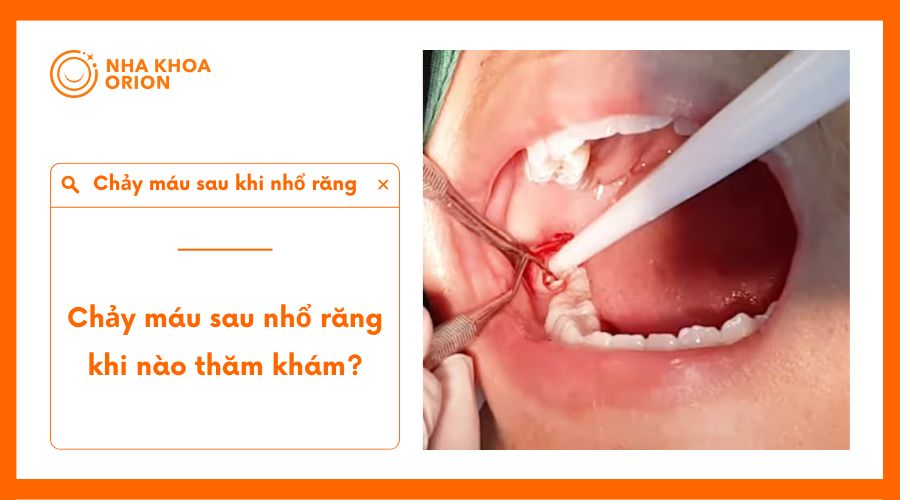 Thăm kh&aacute;m b&aacute;c sĩ khi xuất hiện c&aacute;c triệu chứng bất thường