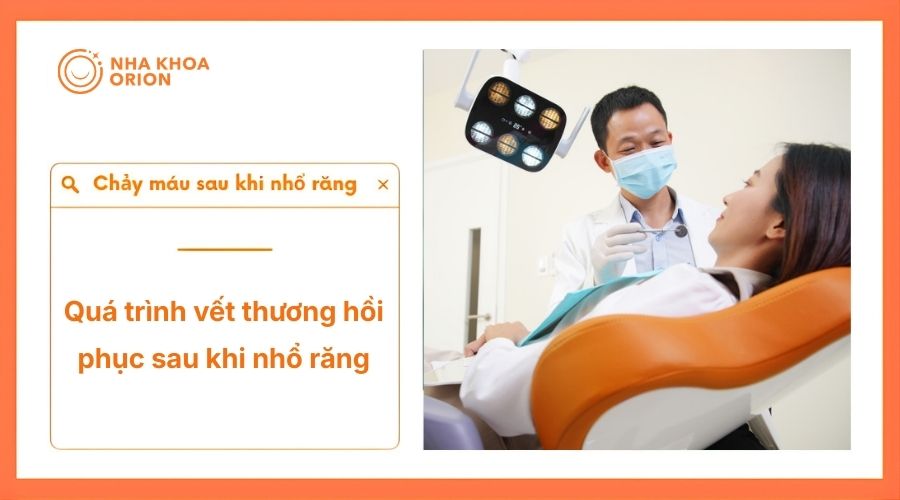 Tần suất chảy m&aacute;u sau khi nhổ răng