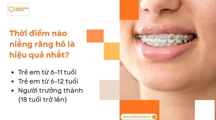 Thời điểm n&agrave;o niềng răng h&ocirc; l&agrave; hiệu quả nhất?