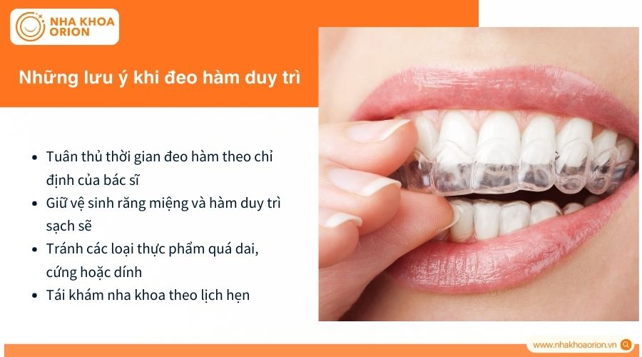 Những lưu &yacute; quan trọng khi đeo h&agrave;m duy tr&igrave;