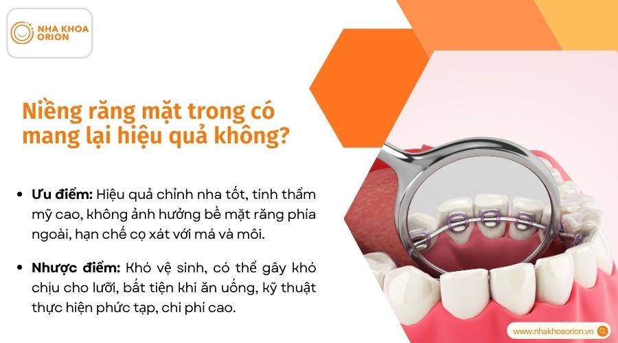 Niềng răng mặt trong c&oacute; hiệu quả kh&ocirc;ng?