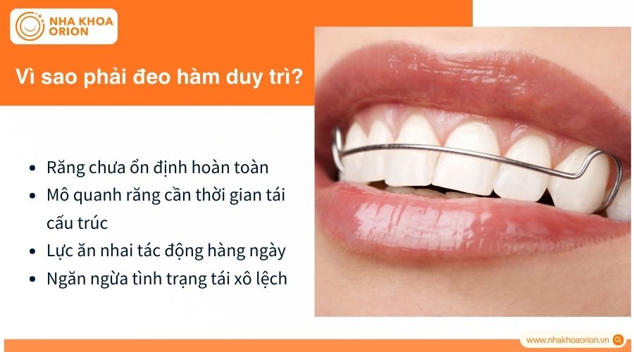 Đeo h&agrave;m duy tr&igrave; gi&uacute;p ngăn răng dịch chuyển trở lại vị tr&iacute; cũ