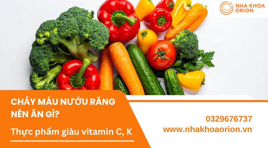 Chảy m&aacute;u nướu răng n&ecirc;n bổ sung thực phẩm gi&agrave;u vitamin C, K