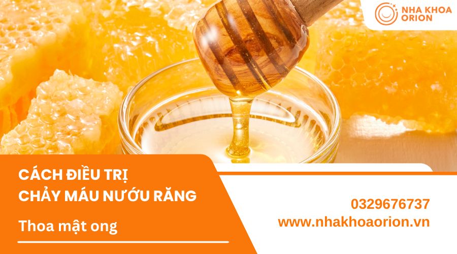 Mật ong gi&uacute;p kh&aacute;ng vi&ecirc;m, giảm chảy m&aacute;u ở nướu
