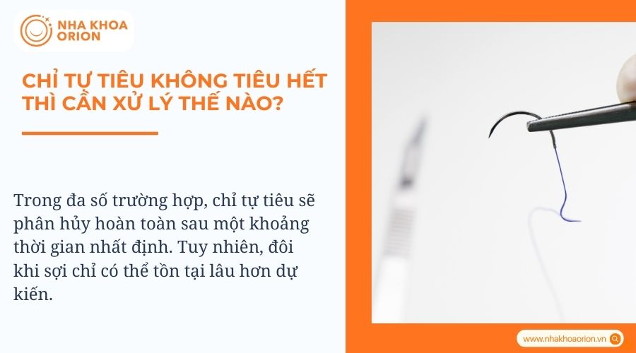 Chỉ tự tiêu không tiêu hết thì cần xử lý thế nào?
