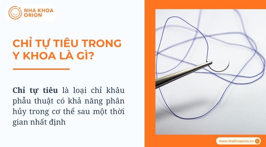 Chỉ tự tiêu là gì?