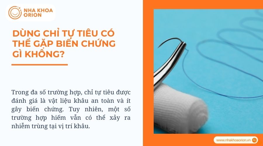 Dùng chỉ tự tiêu có thể gặp biến chứng gì không?