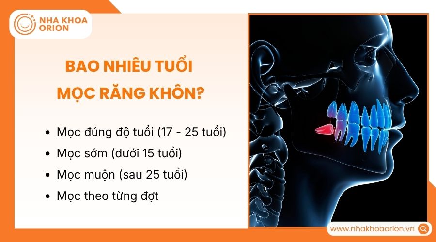 Răng khôn thường mọc khi bạn 17 - 25 tuổi tùy cơ địa