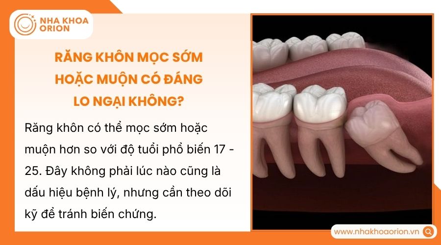 Răng khôn mọc sớm hay muộn không phải do bệnh lý