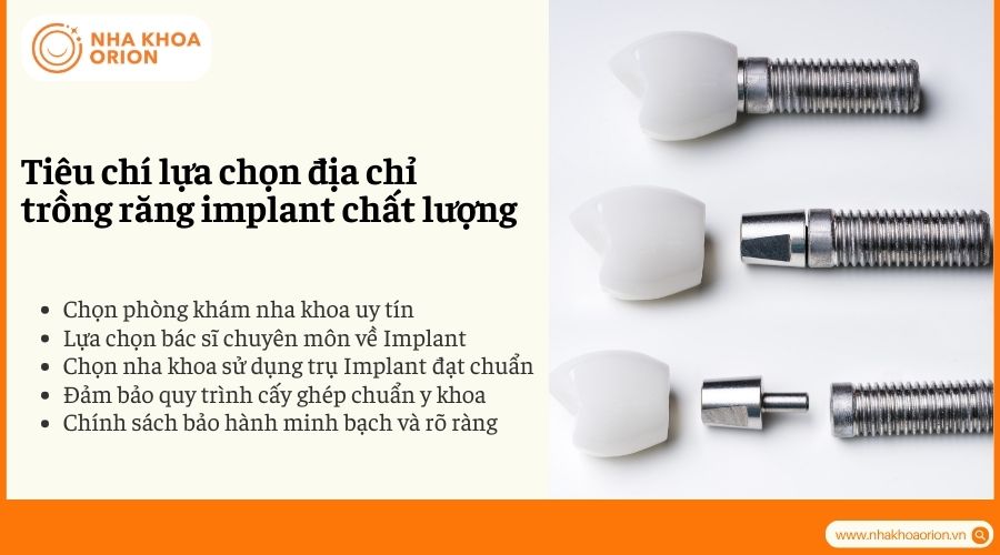 Ti&ecirc;u ch&iacute; lựa chọn địa chỉ trồng răng implant chất lượng