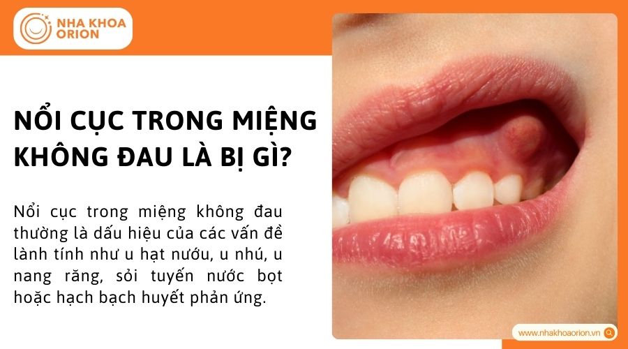 Nổi cục trong miệng kh&ocirc;ng đau l&agrave; bị g&igrave;?