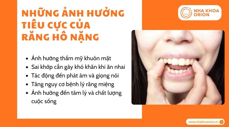 Răng h&ocirc; nặng ảnh hưởng đến thẩm mỹ v&agrave; chất lượng cuộc sống