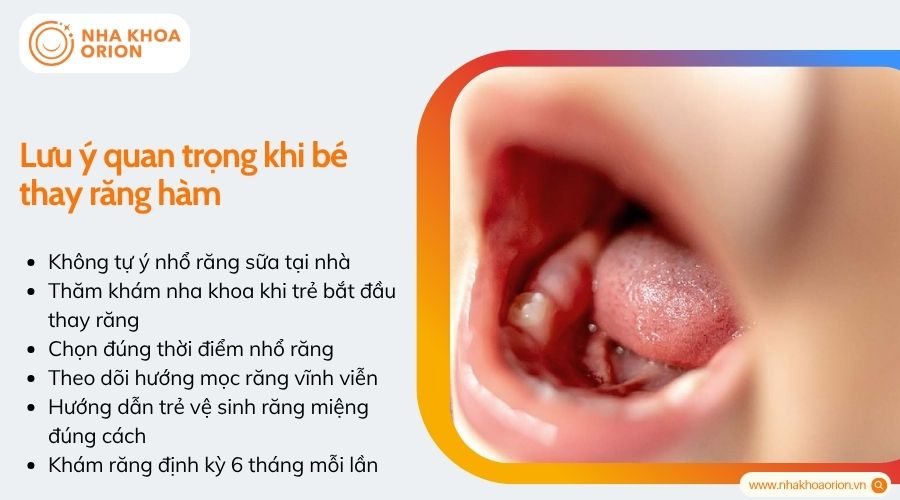 Lưu &yacute; quan trọng khi b&eacute; thay răng h&agrave;m