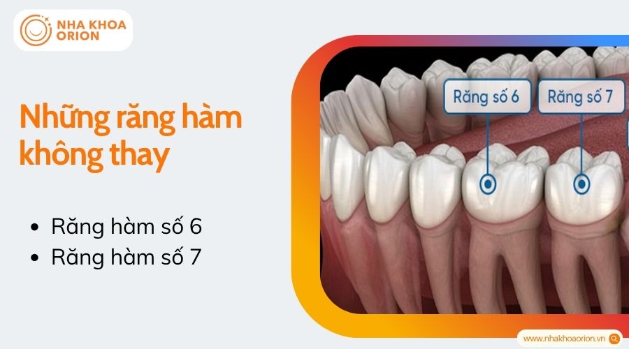 Những răng h&agrave;m kh&ocirc;ng thay