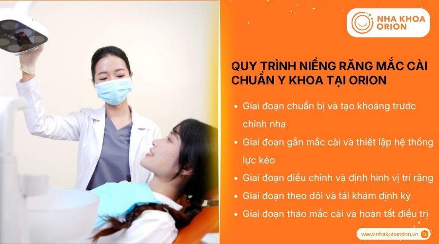 Quy tr&igrave;nh niềng răng mắc c&agrave;i chuẩn y khoa tại Orion