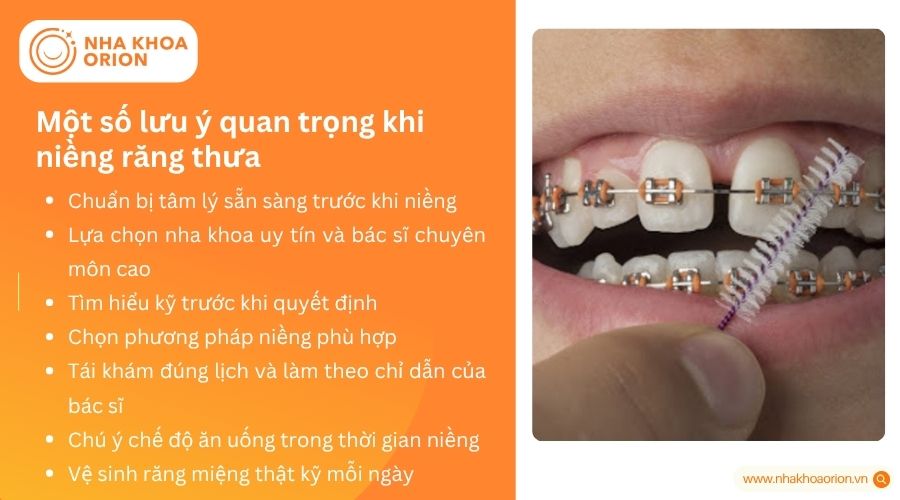 Một số lưu ý quan trọng khi niềng răng thưa