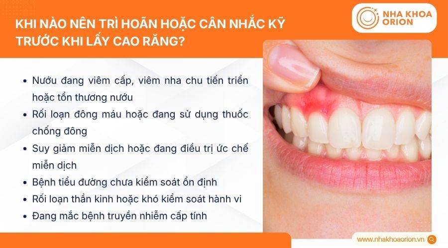Khi n&agrave;o n&ecirc;n tr&igrave; ho&atilde;n hoặc c&acirc;n nhắc kỹ trước khi lấy cao răng?